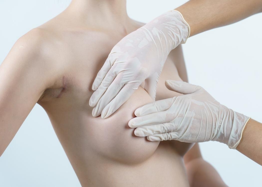 Breast Aesthetics in Istanbul